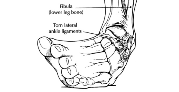 Inverted ankle joint